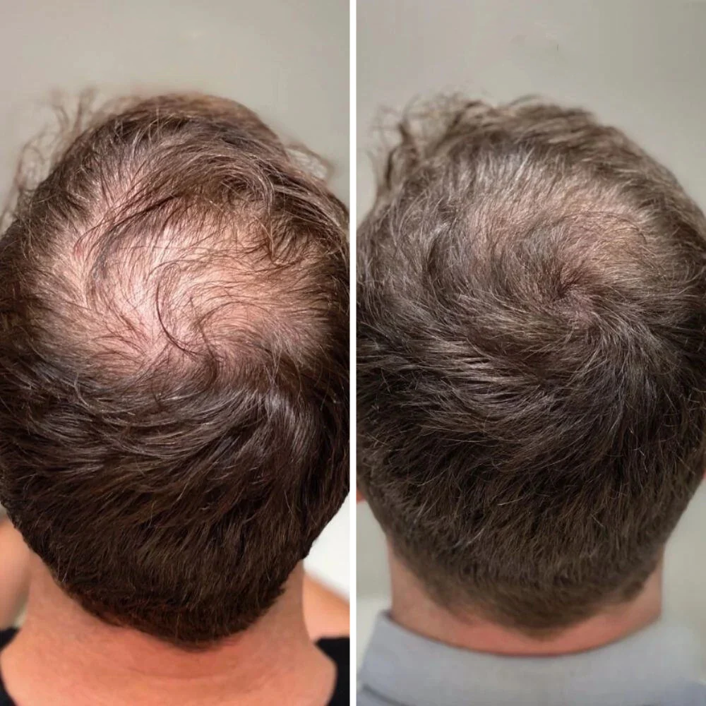 Before and After