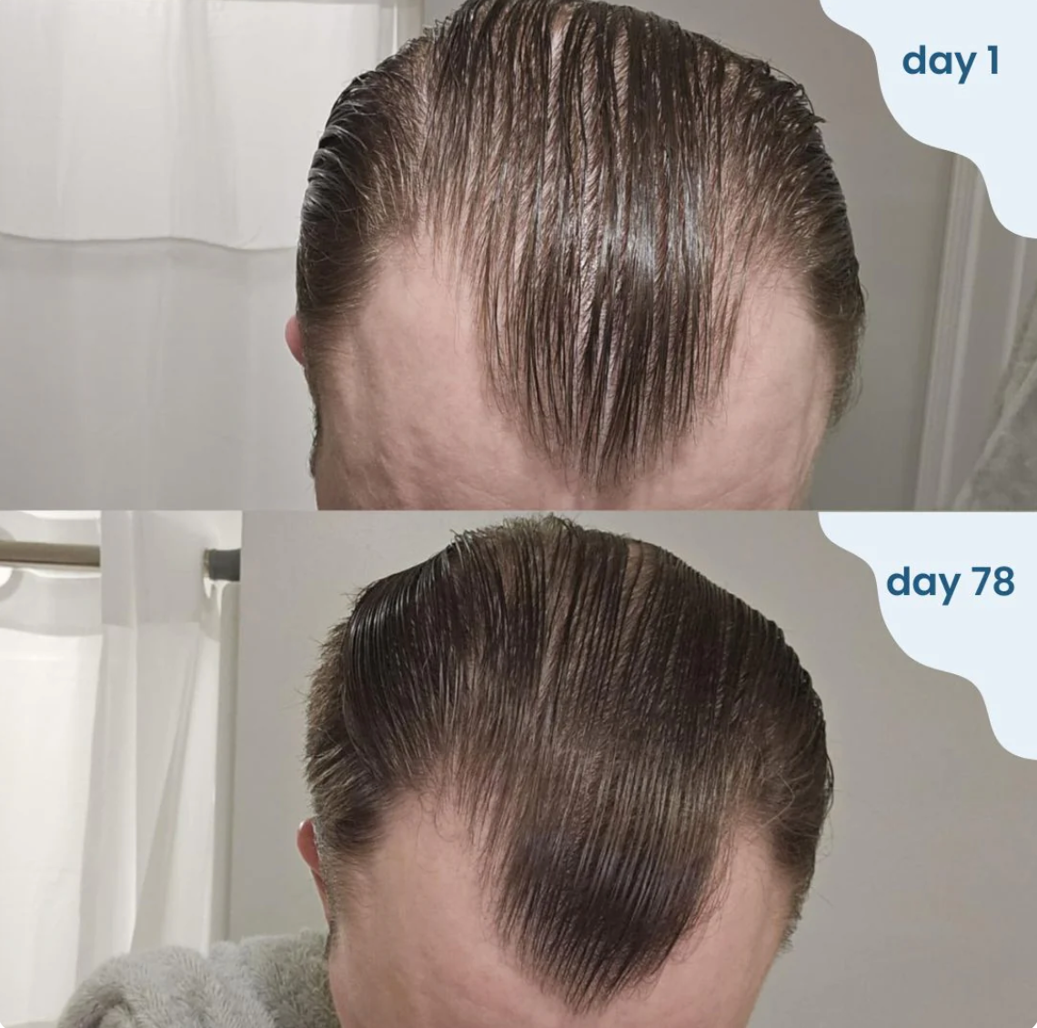 Luema Roll On Hair Growth Serum