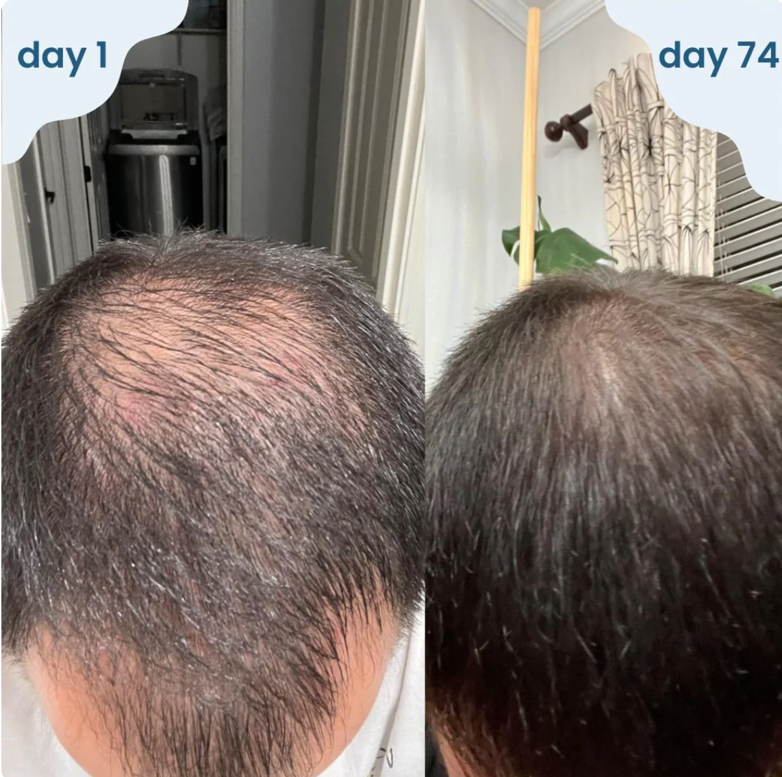 Luema Roll On Hair Growth Serum